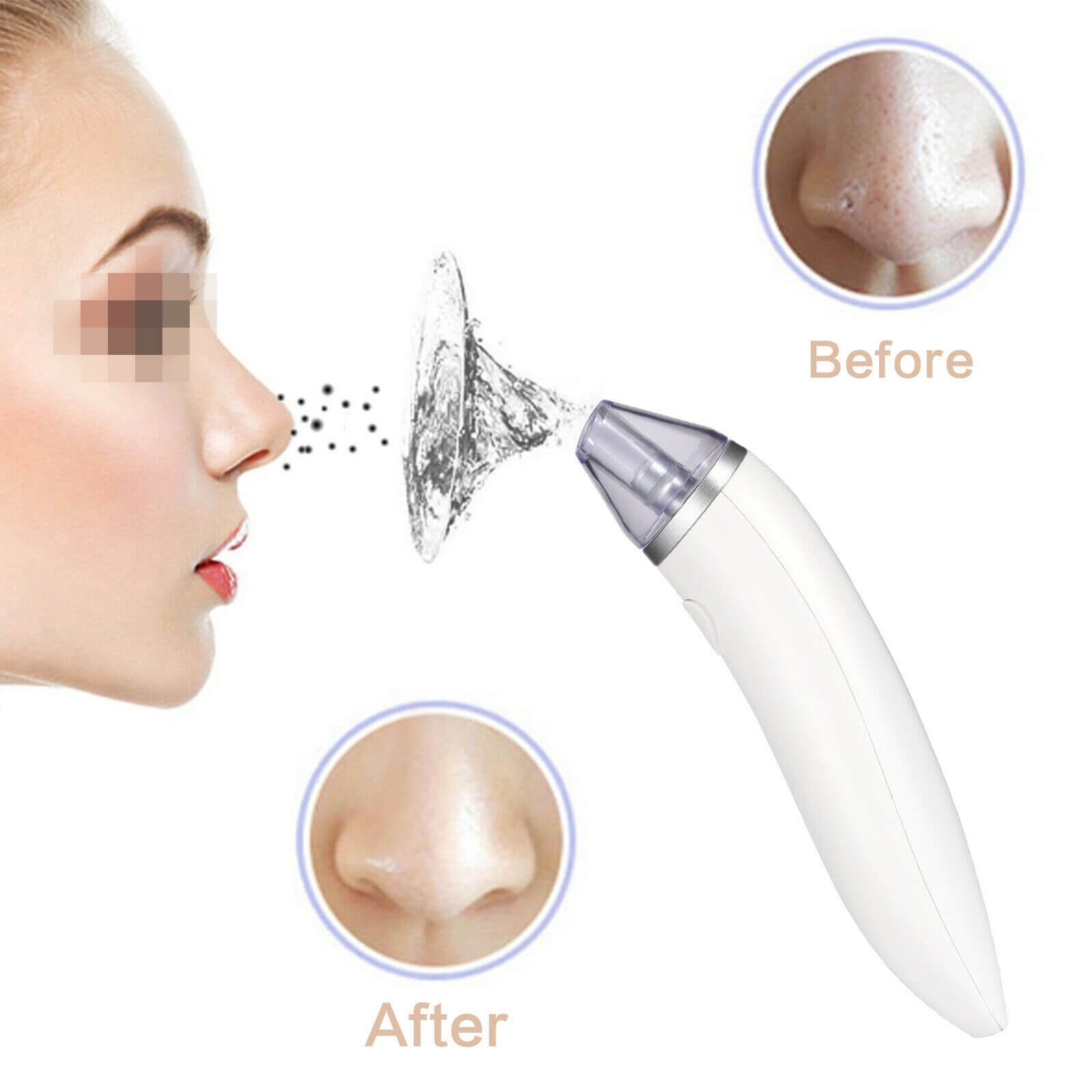 Blackhead Remover Pore Cleanser Tool - BCBMALL